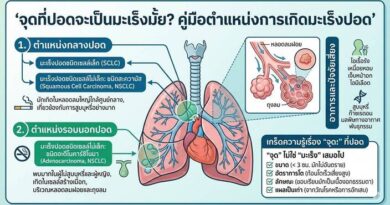 “เจอจุดที่ปอด” ต้องกังวลแค่ไหน?